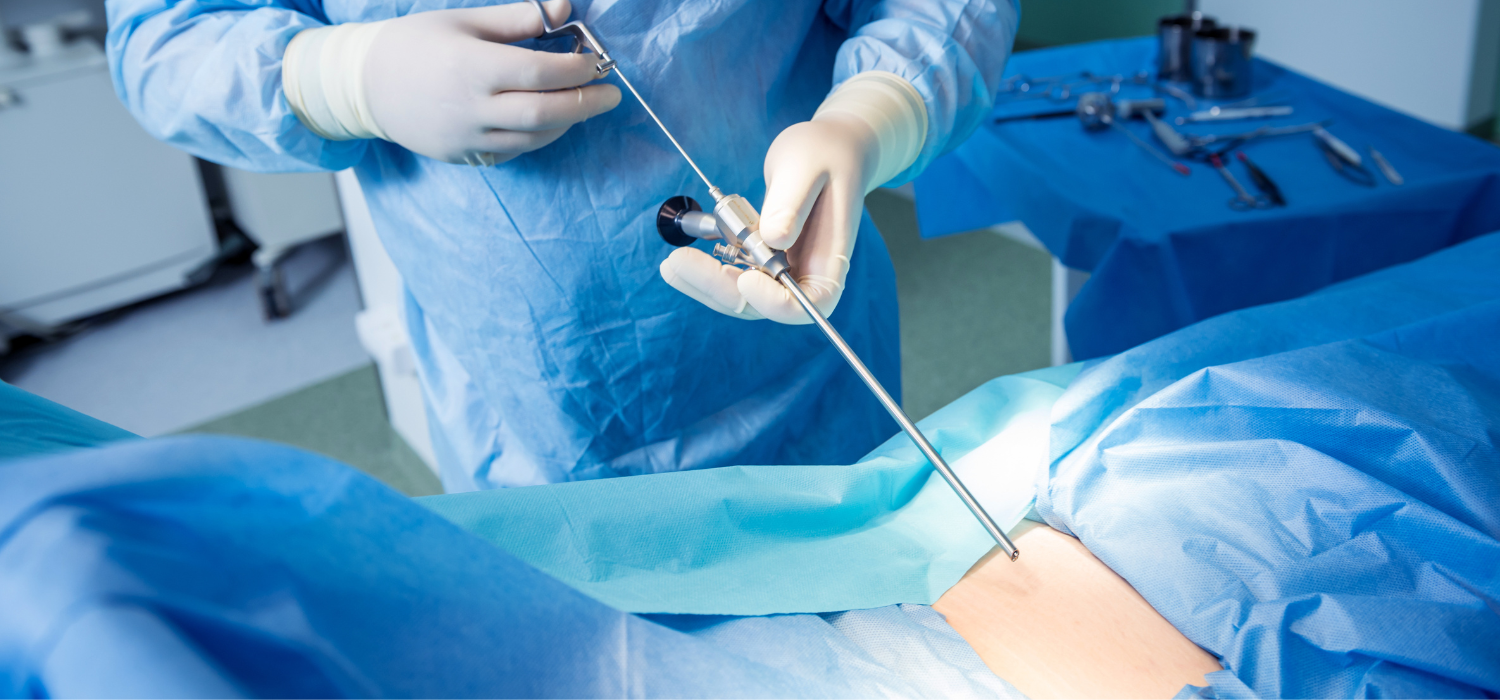 Palloncino Gastrico Endoscopico Napoli