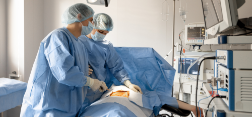 Palloncino Gastrico Salerno