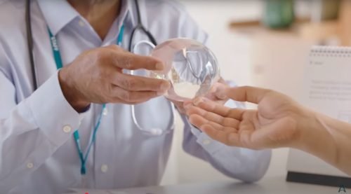 palloncino-gastrico-stella-Avellino