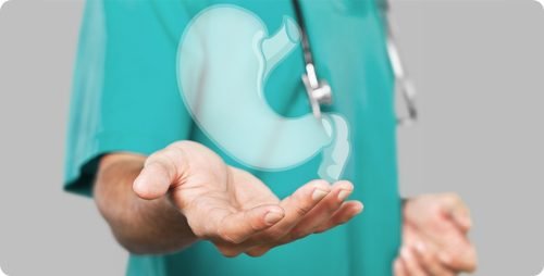 palloncino gastrico stella caserta